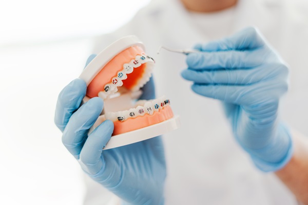 How Often Do Braces Need to be Tightened? - Ashley Family Dental ...