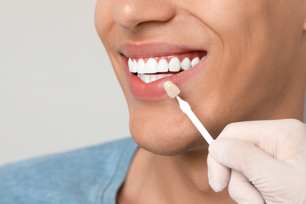 Dental Crowns: Common Issues And How To Address Them